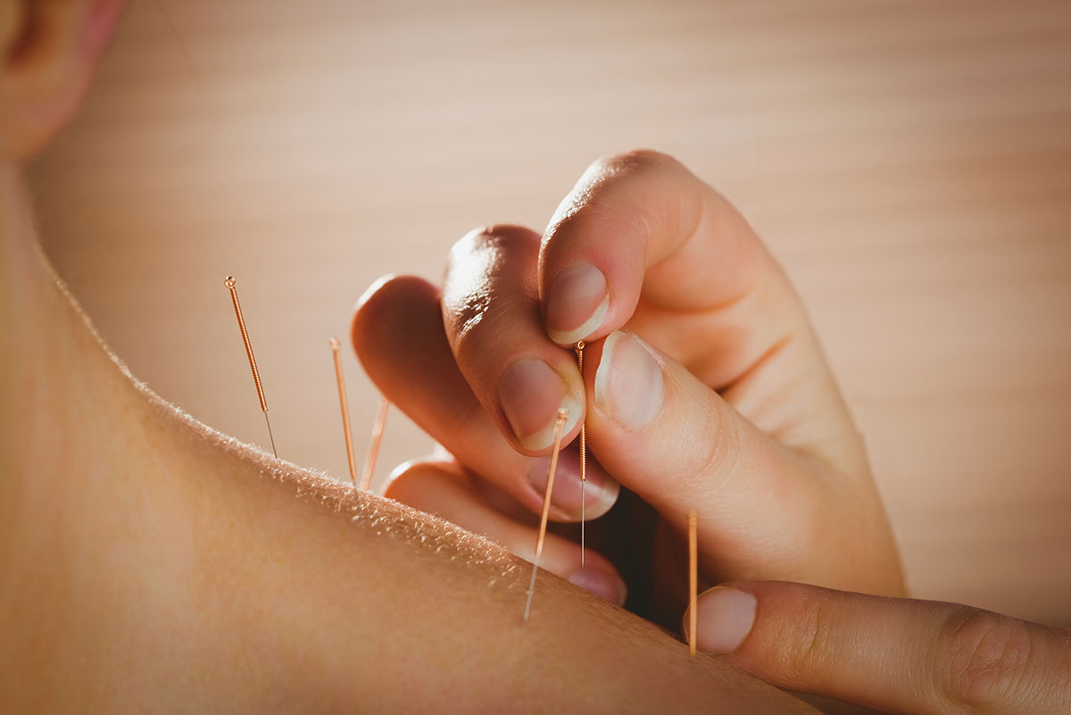 Access-Medical-Center-ACUPUNCTURE